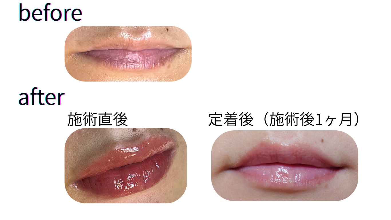 一般歯科