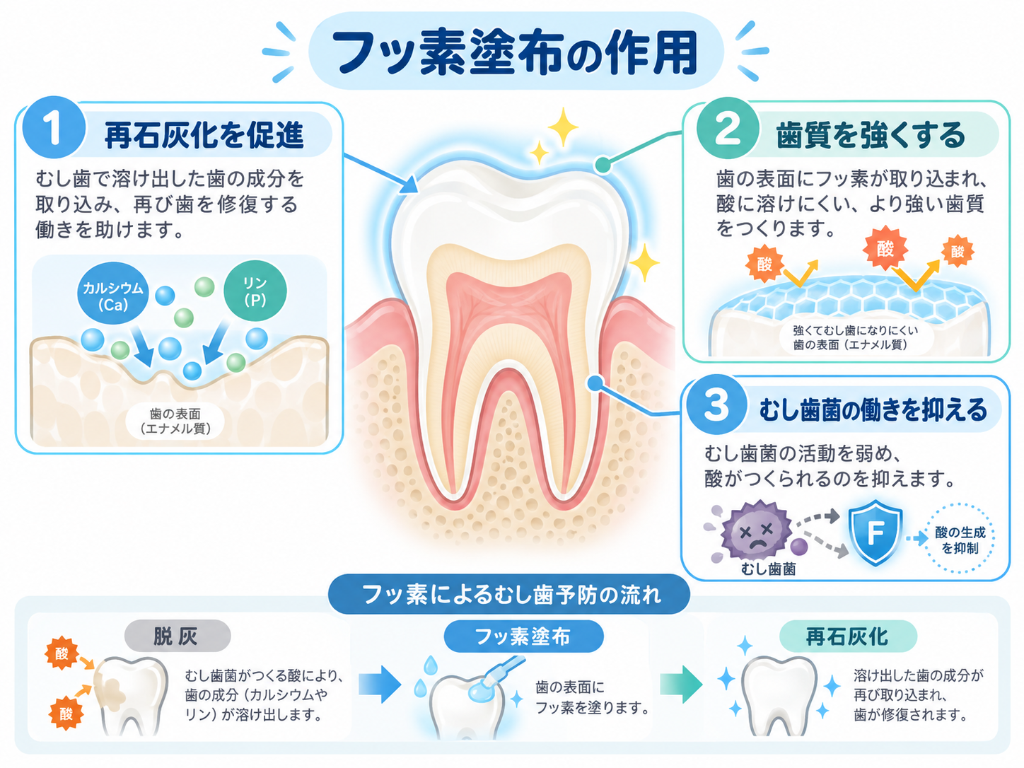 フッ素塗布の作用を説明するイラスト