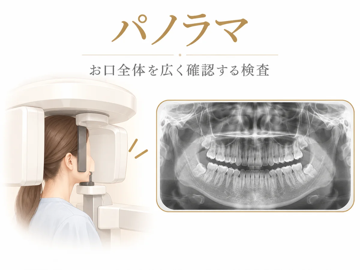 パノラマレントゲン検査のイメージ。上下の歯と顎の骨を広い範囲で確認する検査